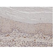 IHC of mouse forestomach squamous epithelium labeled with DSHB antibody C651.6DbHN against Notch2 intracellular domain. PMID: 31276933, Fig. 5D.
